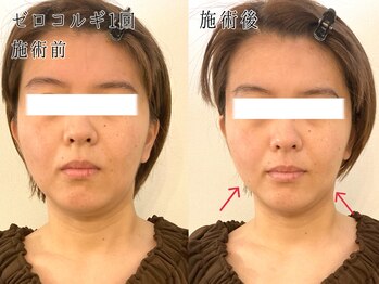 サロン カピリナ(salon Kapilina)/【before→after】