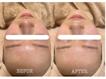 リス ブラン(Lys Blanc)/リゼネレートフェイシャル