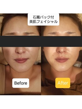 プリマ(prima)/小顔・美白・快眠の３拍子