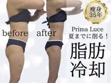 プリマルーチェ