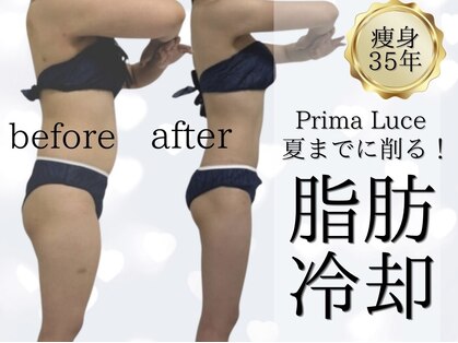 プリマルーチェの写真