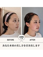 ふらっとエステ/本来の美しさを引き出します