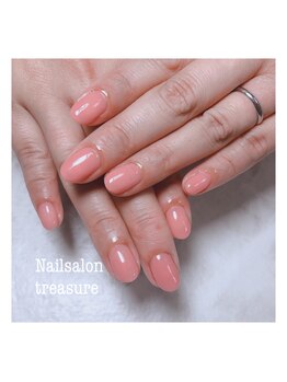 トレジャー(treasure)/