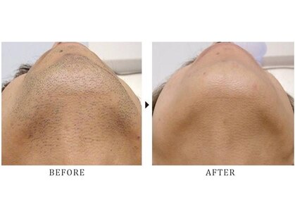 トラスト(TRUST)の写真