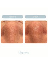 マグノリア(Magnolia)/