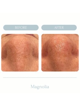 マグノリア(Magnolia)/