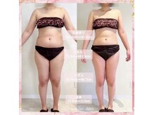 デジール(DESIR)/【痩】下半身１０回コース５か月