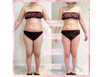 デジール(DESIR)/【痩】下半身１０回コース５か月