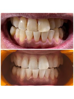 ワイズサロン(Y's salon)/メンテナンスで定期的にが大事