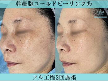 リメイク 広尾(REMAKE)/