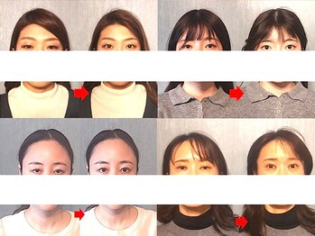 アトラス/初回のお客様のBefore＆after