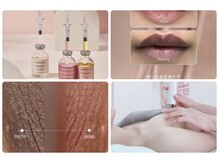 ラリュール(L'ALLURE)の雰囲気(流行りの韓国肌管理★ルメラのメラニンケアメニュー導入しました)