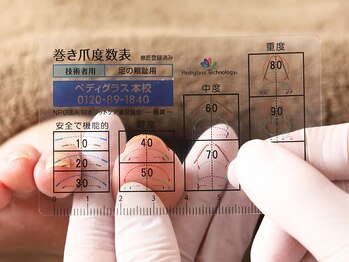 ルポ 伊勢/巻き爪の巻き具合