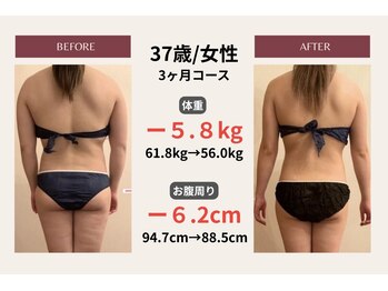 ピアリーノ(Pialino)/