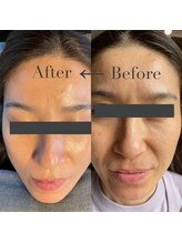 エヌ アンド エイチ ソニックフィット(N&H sonicfit)/お肌のエイジングケアコース