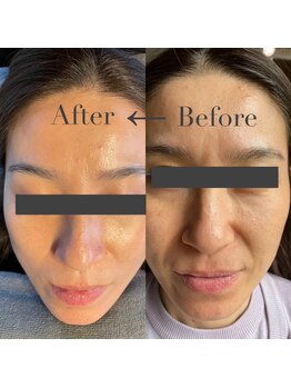 エヌ アンド エイチ ソニックフィット(N&H sonicfit)/お肌のエイジングケアコース