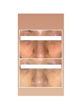 オアジスパ(Oasi Spa)/バイオセルショット65