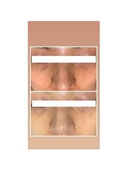 オアジスパ(Oasi Spa)/バイオセルショット65