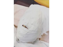 アキュピタル(acupital)