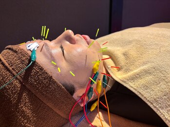 森の鍼灸院 京都下京町家院/電気美容鍼