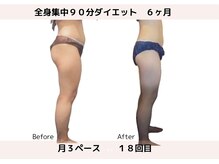 アンドケー(&K)/６ヶ月　１８回