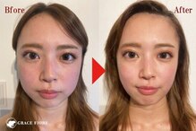 グレースフィオーレ 吉祥寺店(gracefiore)