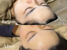 ヴィーナスプロ 岡山駅前(Venus Pro)の雰囲気（【顔脱毛】1回のワックス脱毛で、ここまで垢抜けます♪）