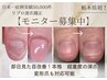 栃木県初【再発させない深爪矯正】即日見た目改善¥23100→モニター価格¥12900