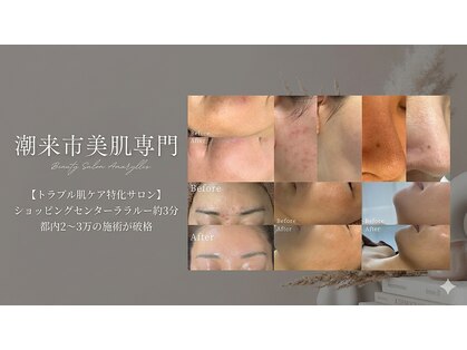 アマリリス(Amaryllis)の写真
