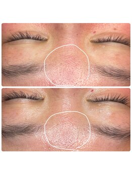 ヒメミ(Himemi)/艶肌Wax