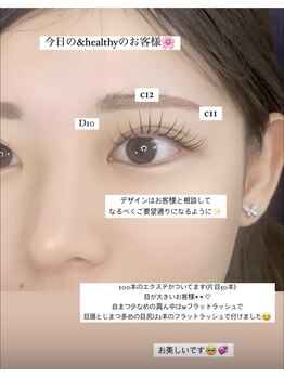 プラセル(placer)/