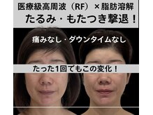 サロン ド ナース ユー ソナ(salon de nurse U.sona)