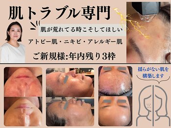 アーブル(Agreable)