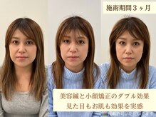 専門性の高い産前産後ケア、美容施術をご提供します♪