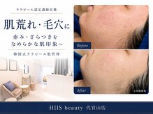 ヒースビューティ 代官山店(HIIS beauty)