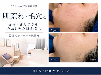 ヒースビューティ 代官山店(HIIS beauty)の写真