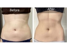 プリズミント(Prismint)/脂肪燃焼パック