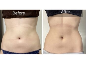 プリズミント(Prismint)/脂肪燃焼パック