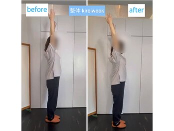 きれいウィーク 恵比寿/肩の違和感解消。