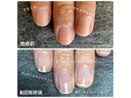 マイカネイルズ(maika nails)の写真