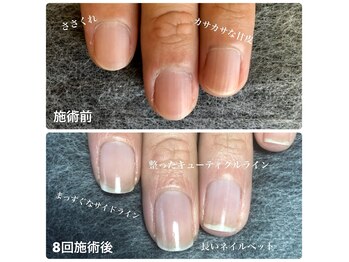 マイカネイルズ(maika nails)