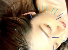 立川レディース鍼灸マッサージ はるはる/透明感のある健やかな美肌へ☆