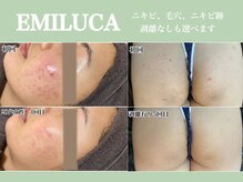 エミルカ 名古屋(EMILUCA)