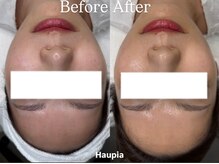 ハウピア(Haupia)/肌が弱い人ほどララピールを