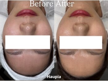 ハウピア(Haupia)/肌が弱い人ほどララピールを