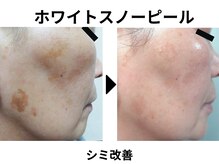 ラディアント たまプラーザ