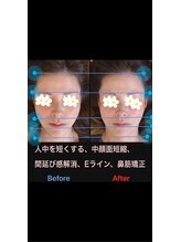 美容矯正サロン レレポノ(LELEPONO)/