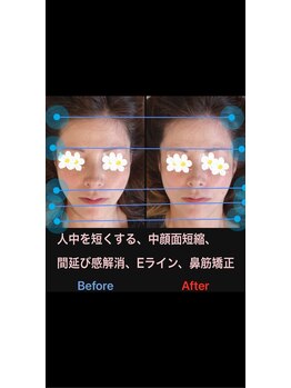 美容矯正サロン レレポノ(LELEPONO)/