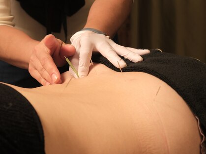 チョウノヤシロの写真