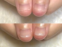 グラシナ 鳥丸店/(深爪/長さだし/フィルイン/)